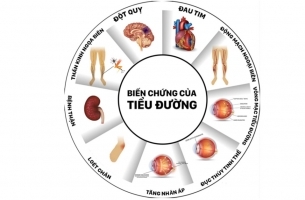 Cảnh Giác Với Các Biến Chứng Nguy Hiểm Của Bệnh Tiểu Đường