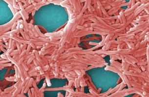 Phát Hiện Virus Bí Ẩn Gây Ra Dịch Viêm Phổi Tại Argentina